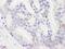 DExH-Box Helicase 9 antibody, NB110-40578, Novus Biologicals, Immunohistochemistry frozen image 
