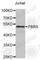 Fibrosin antibody, A4927, ABclonal Technology, Western Blot image 