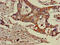 Golgi Associated, Gamma Adaptin Ear Containing, ARF Binding Protein 3 antibody, LS-C678065, Lifespan Biosciences, Immunohistochemistry paraffin image 