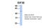 Eukaryotic Translation Initiation Factor 3 Subunit E antibody, 26-291, ProSci, Western Blot image 