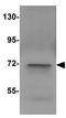 NLR Family Pyrin Domain Containing 10 antibody, GTX85154, GeneTex, Western Blot image 