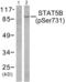 Signal Transducer And Activator Of Transcription 5B antibody, abx012425, Abbexa, Western Blot image 