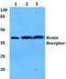 ATPase H+ Transporting Accessory Protein 2 antibody, A02665-1, Boster Biological Technology, Western Blot image 