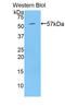 Transglutaminase 1 antibody, LS-C303276, Lifespan Biosciences, Western Blot image 