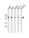 Proteasome 26S Subunit, Non-ATPase 3 antibody, M08767, Boster Biological Technology, Western Blot image 