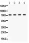 ATP Binding Cassette Subfamily G Member 2 (Junior Blood Group) antibody, PB9364, Boster Biological Technology, Western Blot image 