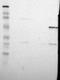 Methyl-CpG Binding Protein 2 antibody, NBP1-81027, Novus Biologicals, Western Blot image 