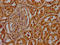 Histone Cluster 1 H1 Family Member C antibody, LS-C676864, Lifespan Biosciences, Immunohistochemistry paraffin image 