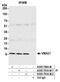 Vacuolar ATPase Assembly Factor VMA21 antibody, A305-701A-M, Bethyl Labs, Immunoprecipitation image 