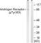 Androgen Receptor antibody, LS-C198630, Lifespan Biosciences, Western Blot image 