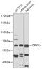 Dihydropyrimidinase Like 4 antibody, 18-005, ProSci, Western Blot image 
