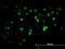 Zinc Finger Protein 496 antibody, H00084838-M08, Novus Biologicals, Immunocytochemistry image 