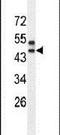 Sprouty Related EVH1 Domain Containing 3 antibody, PA5-23767, Invitrogen Antibodies, Western Blot image 