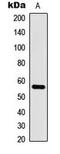 CDC Like Kinase 1 antibody, MBS8204256, MyBioSource, Western Blot image 