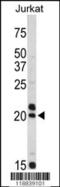 Vasoactive Intestinal Peptide antibody, 62-321, ProSci, Western Blot image 