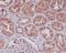 Nuclear Factor Kappa B Subunit 1 antibody, M00283, Boster Biological Technology, Immunohistochemistry paraffin image 