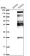 Transforming Acidic Coiled-Coil Containing Protein 3 antibody, PA5-52207, Invitrogen Antibodies, Western Blot image 