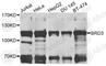 Bromodomain Containing 3 antibody, A2277, ABclonal Technology, Western Blot image 