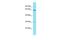 Chromosome 1 Open Reading Frame 127 antibody, PA5-46338, Invitrogen Antibodies, Western Blot image 