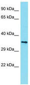 AMMECR1 Like antibody, TA333629, Origene, Western Blot image 
