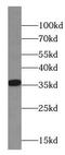 Calponin 2 antibody, FNab01801, FineTest, Western Blot image 