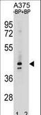 Olfactory Receptor Family 5 Subfamily AC Member 2 antibody, LS-C158018, Lifespan Biosciences, Western Blot image 