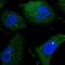 Endo-Beta-N-Acetylglucosaminidase antibody, HPA021551, Atlas Antibodies, Immunofluorescence image 