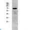 Keratin 5 antibody, LS-C813440, Lifespan Biosciences, Western Blot image 