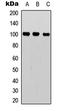 Nuclear Factor Kappa B Subunit 2 antibody, LS-C368448, Lifespan Biosciences, Western Blot image 