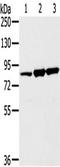 SUMO Specific Peptidase 5 antibody, TA350400, Origene, Western Blot image 