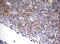 Spermatogenesis Associated 2 Like antibody, M19404, Boster Biological Technology, Immunohistochemistry paraffin image 