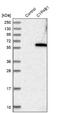 Cytochrome P450 Family 4 Subfamily B Member 1 antibody, NBP1-86142, Novus Biologicals, Western Blot image 