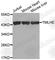 Trimethyllysine Hydroxylase, Epsilon antibody, A2320, ABclonal Technology, Western Blot image 