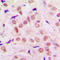 Transcriptional Repressor GATA Binding 1 antibody, LS-C354105, Lifespan Biosciences, Immunohistochemistry paraffin image 