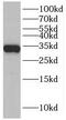 Solute Carrier Family 25 Member 22 antibody, FNab07935, FineTest, Western Blot image 
