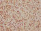 Cell Division Cycle 25C antibody, CSB-RA004996A0HU, Cusabio, Immunohistochemistry paraffin image 