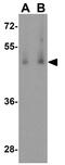 Bone morphogenetic protein 15 antibody, GTX31485, GeneTex, Western Blot image 