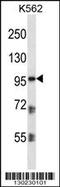 Plakophilin 2 antibody, 56-747, ProSci, Western Blot image 