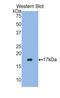 Retinoic Acid Receptor Responder 2 antibody, abx100232, Abbexa, Enzyme Linked Immunosorbent Assay image 