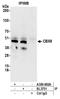 Chromobox 8 antibody, A300-882A, Bethyl Labs, Immunoprecipitation image 