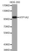 ATPase Na+/K+ Transporting Subunit Alpha 2 antibody, LS-C332754, Lifespan Biosciences, Western Blot image 