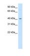 Peroxisome Proliferator Activated Receptor Delta antibody, orb330016, Biorbyt, Western Blot image 