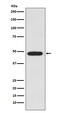 Galactosidase Alpha antibody, M01135, Boster Biological Technology, Western Blot image 