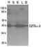 GDNF Family Receptor Alpha 3 antibody, PA5-19875, Invitrogen Antibodies, Western Blot image 