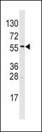 Aldehyde Dehydrogenase 6 Family Member A1 antibody, LS-B8998, Lifespan Biosciences, Western Blot image 