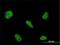 RNA Binding Motif Protein 5 antibody, H00010181-M01, Novus Biologicals, Immunocytochemistry image 