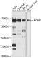 Activity Dependent Neuroprotector Homeobox antibody, GTX17559, GeneTex, Western Blot image 