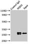 N-Ribosyldihydronicotinamide:Quinone Reductase 2 antibody, LS-C670751, Lifespan Biosciences, Immunoprecipitation image 