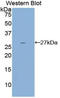 Interleukin 2 Receptor Subunit Beta antibody, LS-C294887, Lifespan Biosciences, Western Blot image 