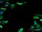 Tubulin Alpha 1b antibody, H00010376-M12, Novus Biologicals, Immunocytochemistry image 